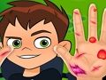 Igra Ben10 Ručni liječnik online Igra Ben10 Ručni liječnik online
