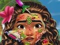 Igra Moana liječnik za kožu online Igra Moana liječnik za kožu online