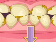Igra Bad Teeth Makeover online
