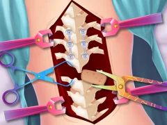 Igra Anna Scoliosis Surgery online