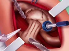 Igra Princess Hips Surgery online