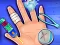 Igra Hand Treatment online