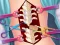 Igra Anna Scoliosis Surgery online