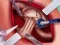Igra Princess Hips Surgery online