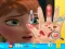 Igra Anna hand doctor online