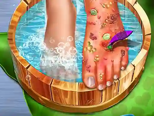 Igra Feet Skin Doctor online