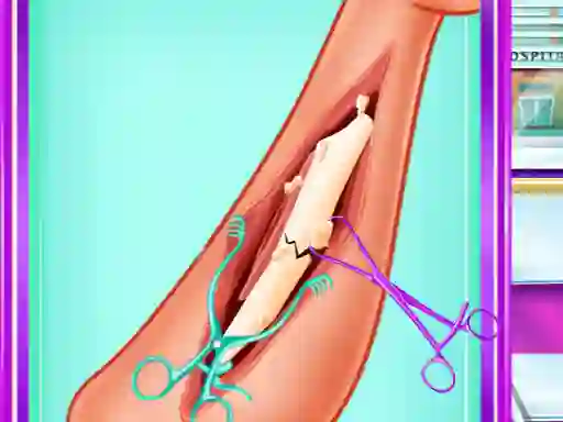 Igra Ladybug Leg Surgery online