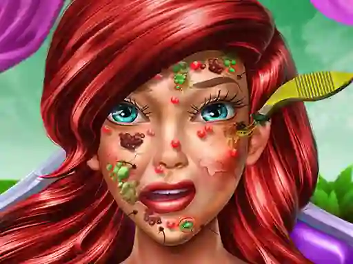 Igra Princess Mermaid Skin Doctor online