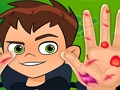 Igra Ben10 Ručni liječnik  online